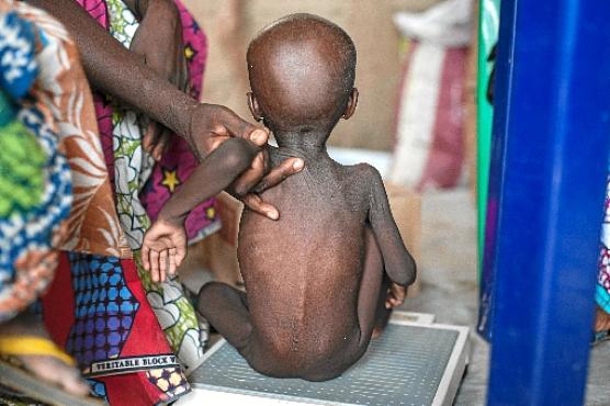 Países latino-americanos e africanos fazem parte da lista: autores alertam para os impactos da má nutrição desde a infância e para a necessidade da participação de diferentes atores sociais para mudar esse quadro  (Stefan Heunis/AFP - 30/6/16)