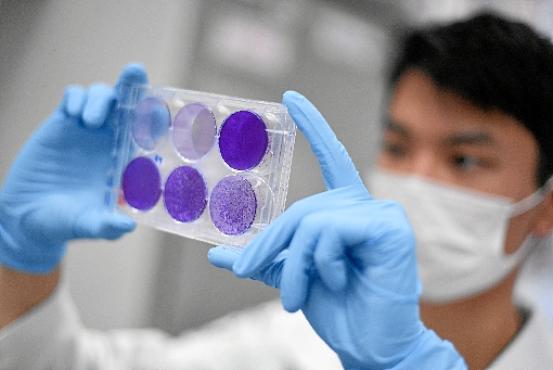 Pesquisador avalia resultado de estudo para vacina contra o coronavírus em MG: Brasil realizará 22,9 milhões de testes nas próximas semanas     (Douglas Magno/AFP)