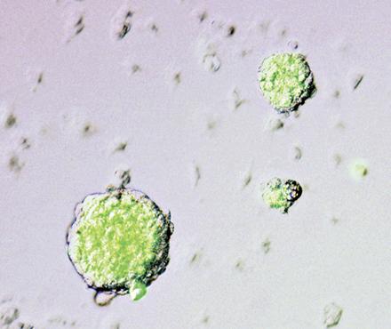 As células STAP: outros centros de pesquisa não conseguem produzi-las  (Riken Center for Developmental Biology/Reuters)