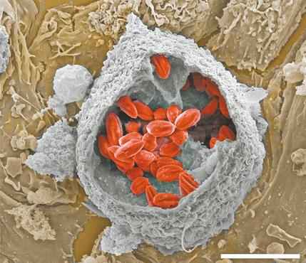 Em vermelho, os vacúolos que abrigam o parasita no interior da célula: os pesquisadores buscam, agora, formas de atacar essa proteção ( Fernando Real/Divulgação )